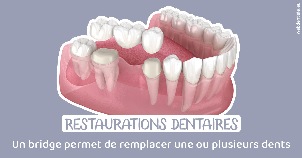 https://selarl-d-arguin.chirurgiens-dentistes.fr/Bridge remplacer dents 1