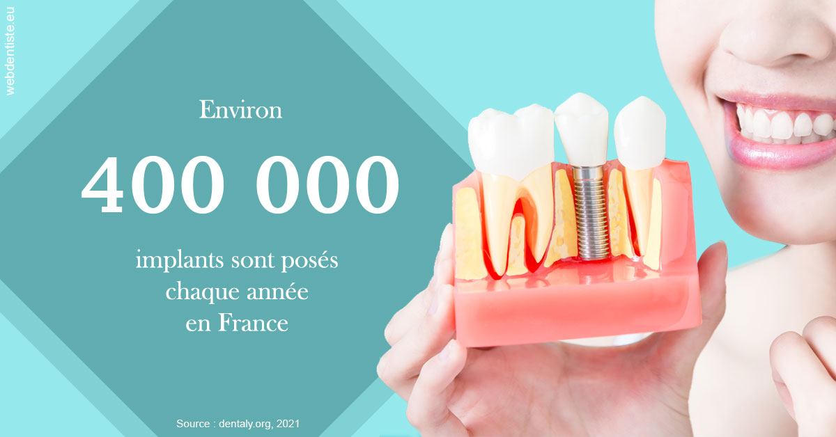 https://selarl-d-arguin.chirurgiens-dentistes.fr/Pose d'implants en France 2