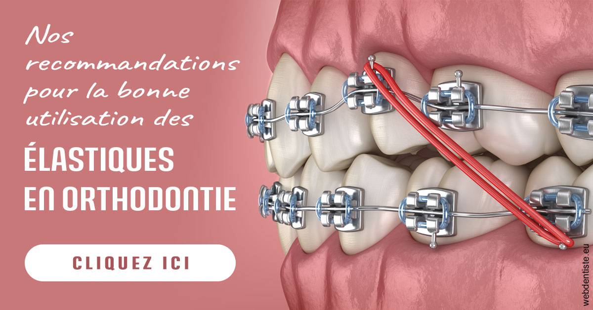 https://selarl-d-arguin.chirurgiens-dentistes.fr/Elastiques orthodontie 2